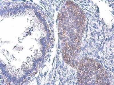Immunohistochemistry-Paraffin: EGFR [p Tyr1045] Antibody [NBP3-13229]